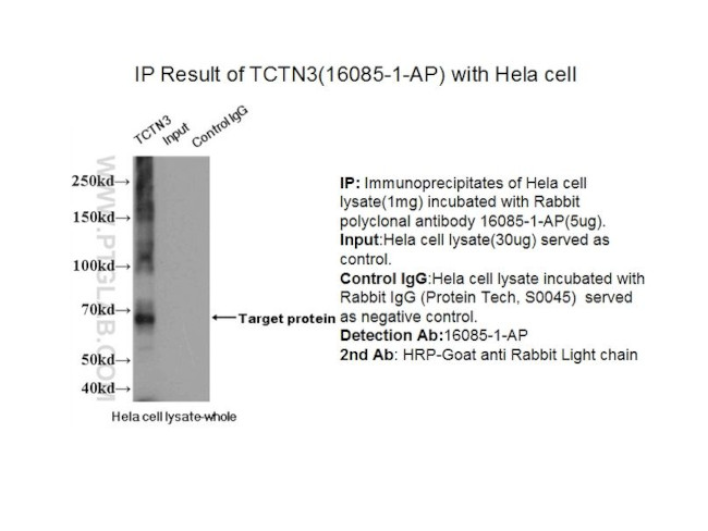 TCTN3 Antibody in Immunoprecipitation (IP)