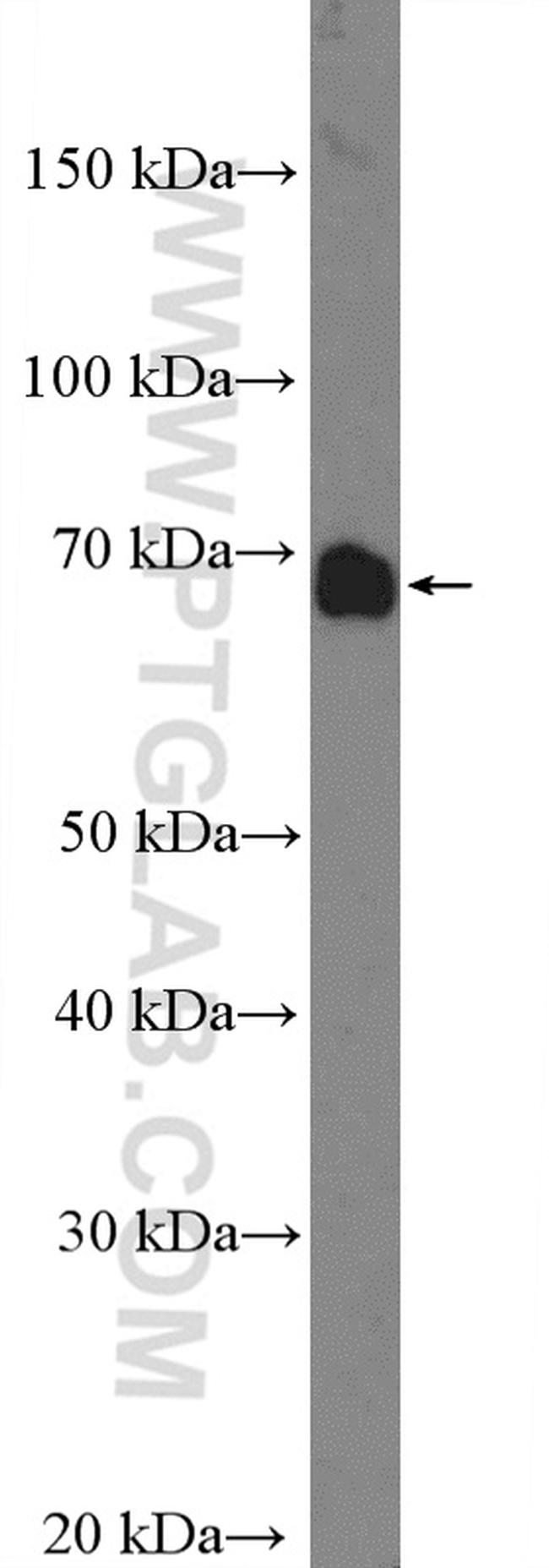 TCTN3 Antibody in Western Blot (WB)