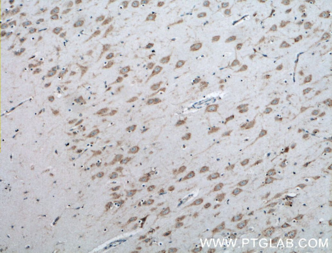 Acetyl CoA synthetase Antibody in Immunohistochemistry (Paraffin) (IHC (P))