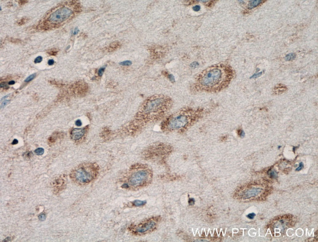 Acetyl CoA synthetase Antibody in Immunohistochemistry (Paraffin) (IHC (P))