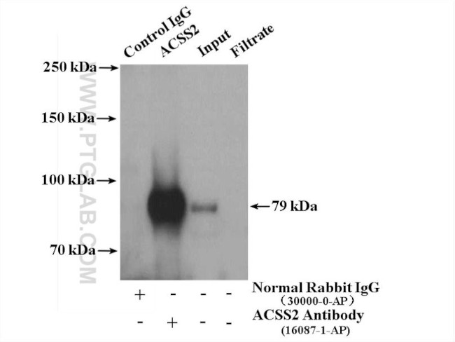 Acetyl CoA synthetase Antibody in Immunoprecipitation (IP)