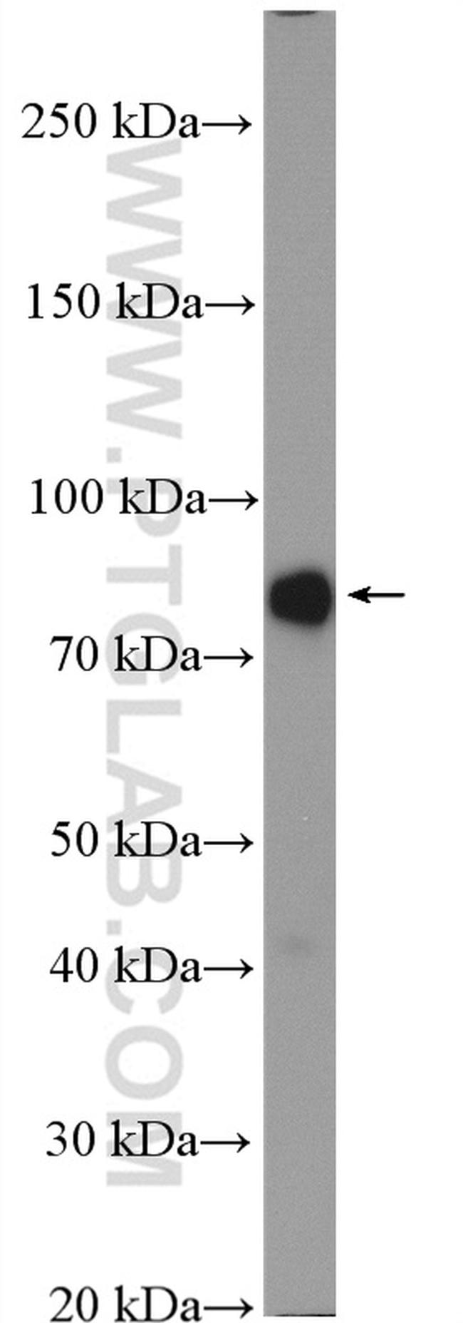 Acetyl CoA synthetase Antibody in Western Blot (WB)