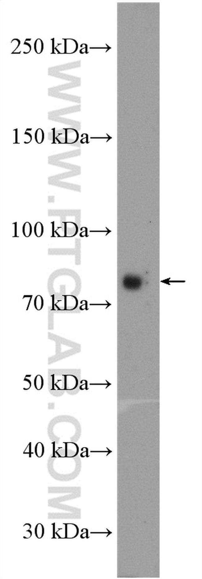 Acetyl CoA synthetase Antibody in Western Blot (WB)