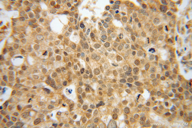 EEF1A2 Antibody in Immunohistochemistry (Paraffin) (IHC (P))