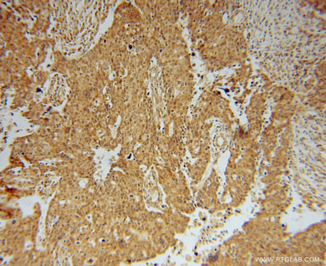 EEF1A2 Antibody in Immunohistochemistry (Paraffin) (IHC (P))