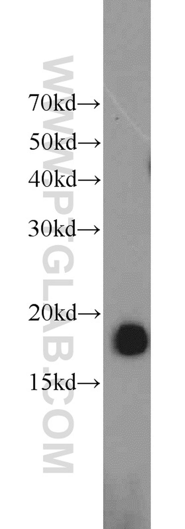 POLR2D Antibody in Western Blot (WB)