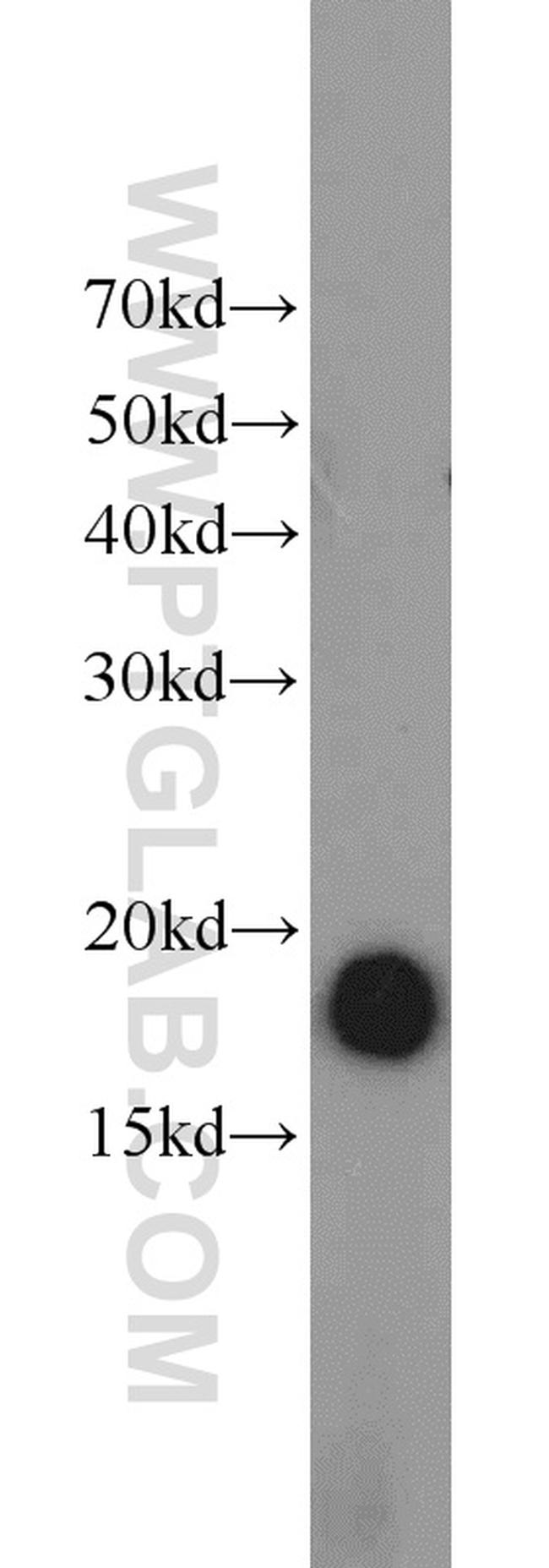 POLR2D Antibody in Western Blot (WB)