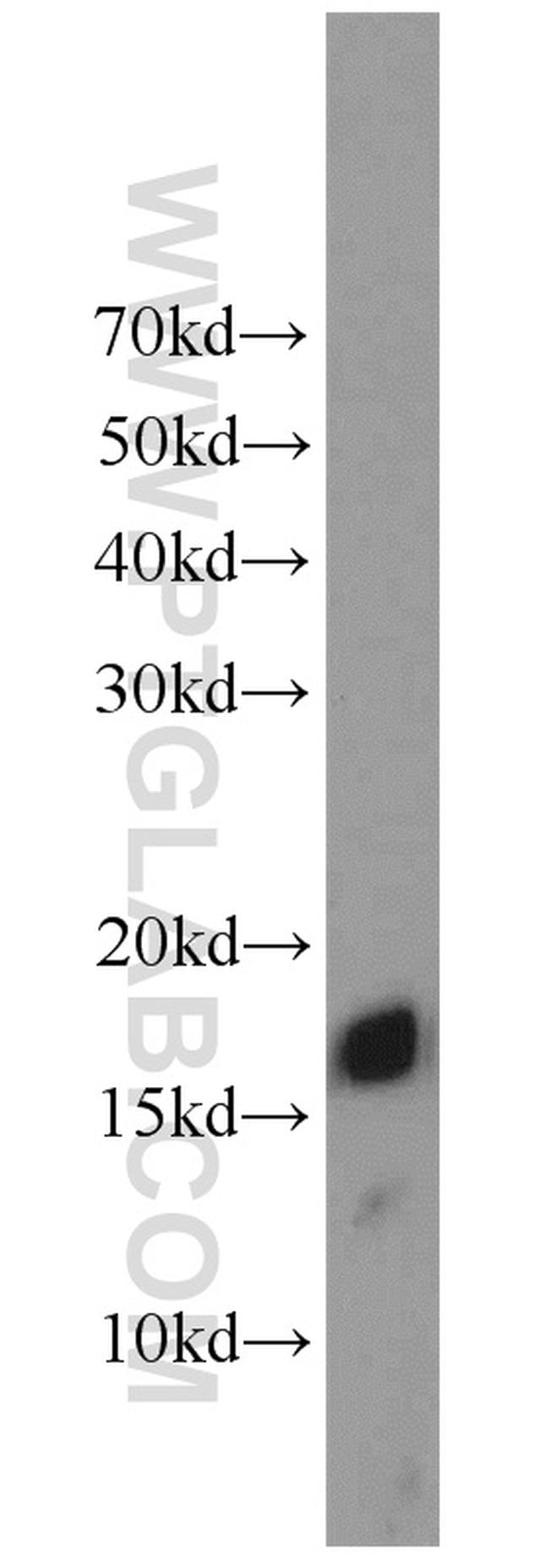 POLR2D Antibody in Western Blot (WB)