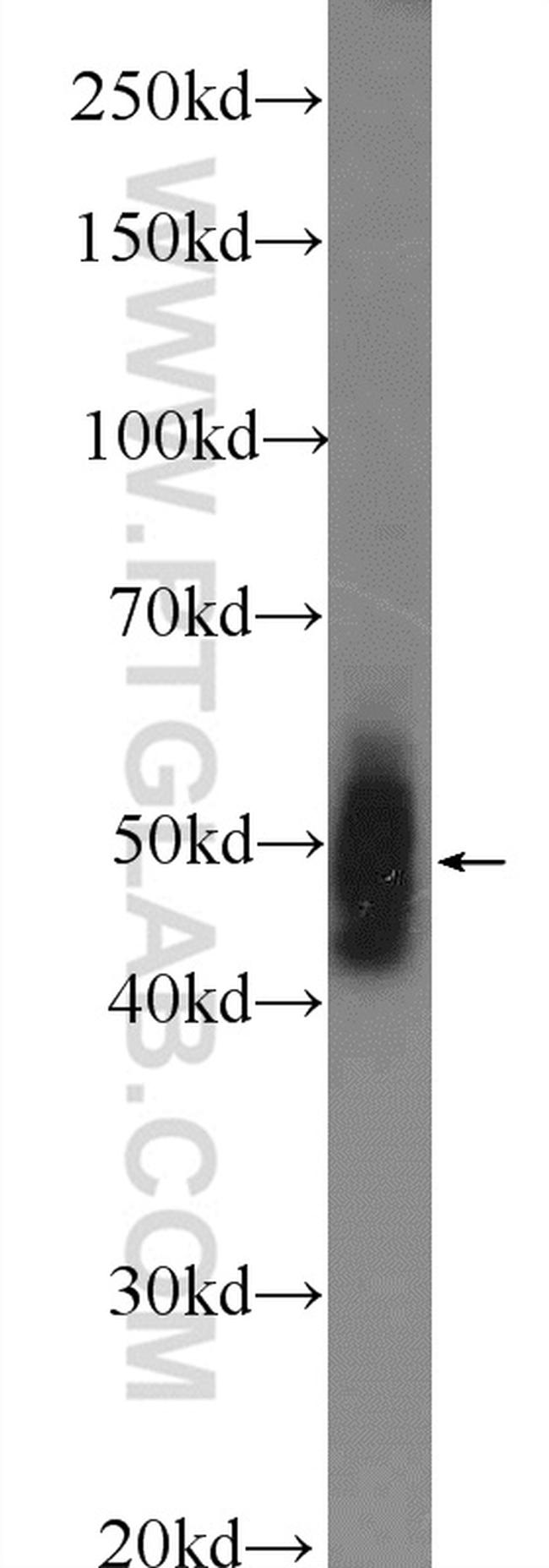 PELI2 Antibody in Western Blot (WB)