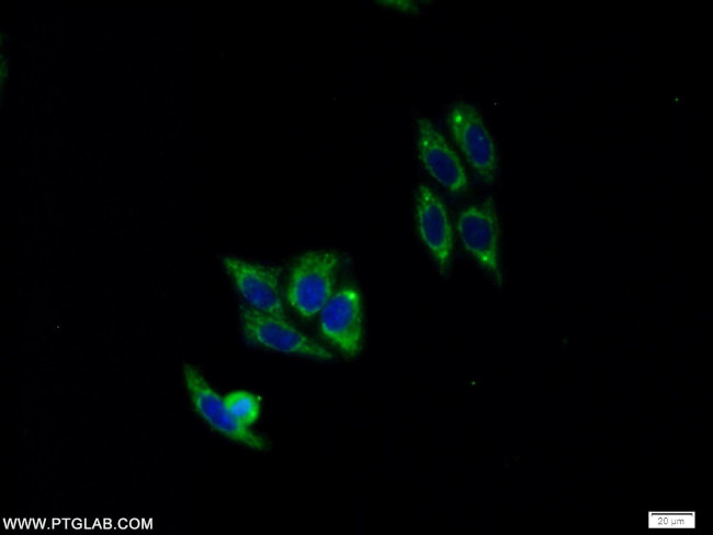 PELI2 Antibody in Immunocytochemistry (ICC/IF)