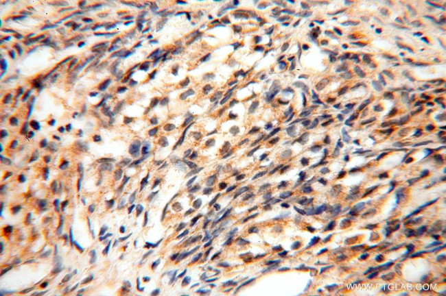 NUDT8 Antibody in Immunohistochemistry (Paraffin) (IHC (P))