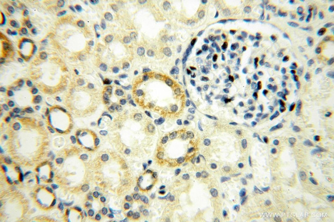 NUDT8 Antibody in Immunohistochemistry (Paraffin) (IHC (P))