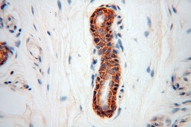 NUDT8 Antibody in Immunohistochemistry (Paraffin) (IHC (P))