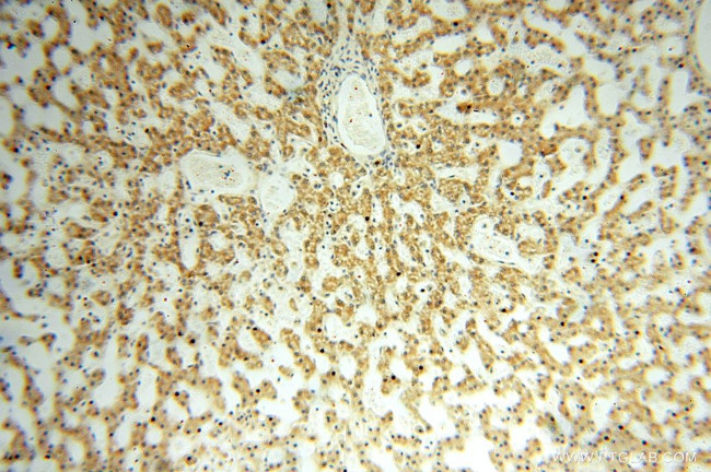 NUDT8 Antibody in Immunohistochemistry (Paraffin) (IHC (P))