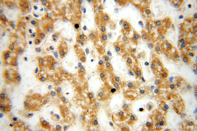 NUDT8 Antibody in Immunohistochemistry (Paraffin) (IHC (P))