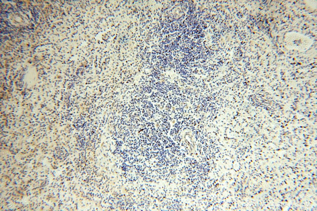 NUDT8 Antibody in Immunohistochemistry (Paraffin) (IHC (P))