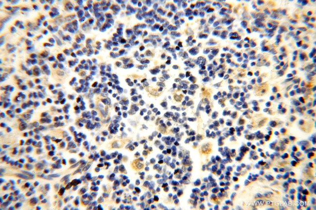 NUDT8 Antibody in Immunohistochemistry (Paraffin) (IHC (P))