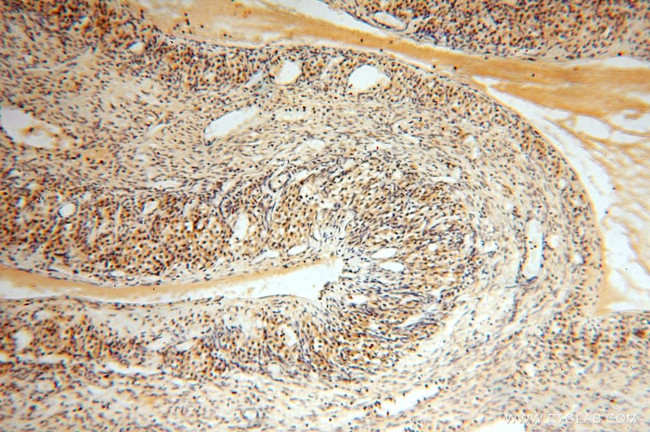 NUDT8 Antibody in Immunohistochemistry (Paraffin) (IHC (P))