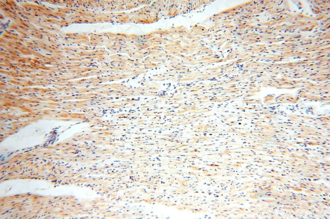 NUDT8 Antibody in Immunohistochemistry (Paraffin) (IHC (P))