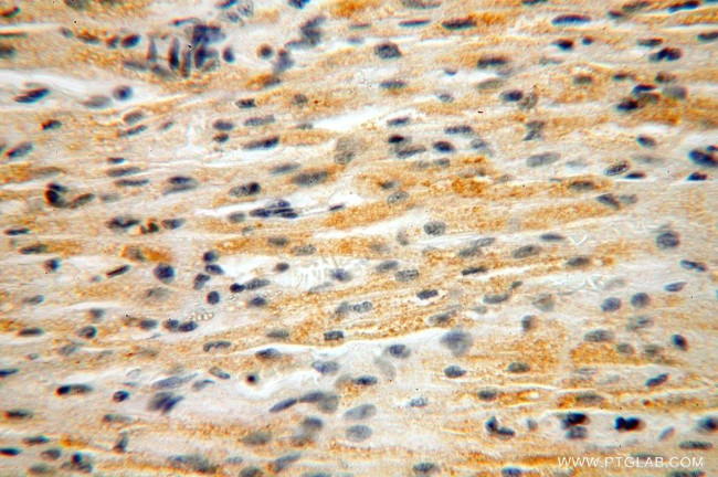 NUDT8 Antibody in Immunohistochemistry (Paraffin) (IHC (P))