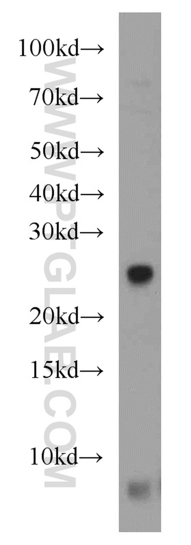 NUDT8 Antibody in Western Blot (WB)