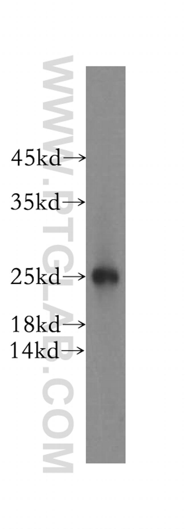 NUDT8 Antibody in Western Blot (WB)