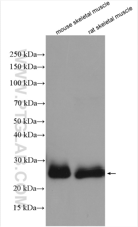 TNNI1 Antibody in Western Blot (WB)