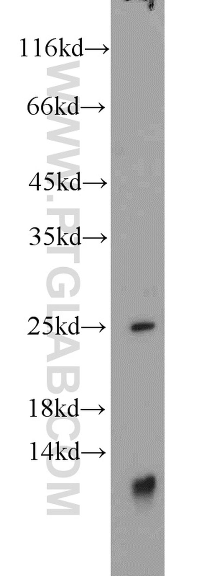 TNNI1 Antibody in Western Blot (WB)