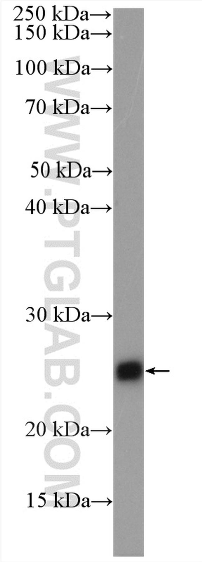 TNNI1 Antibody in Western Blot (WB)