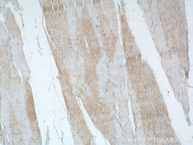 TNNI1 Antibody in Immunohistochemistry (Paraffin) (IHC (P))