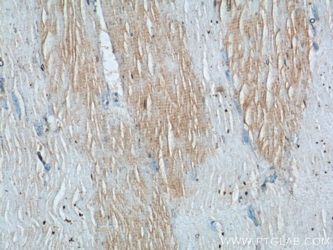 TNNI1 Antibody in Immunohistochemistry (Paraffin) (IHC (P))