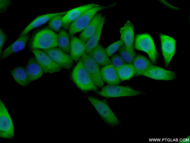 S100A4 Antibody in Immunocytochemistry (ICC/IF)