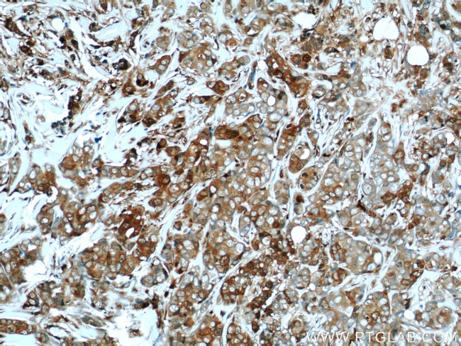 S100A4 Antibody in Immunohistochemistry (Paraffin) (IHC (P))