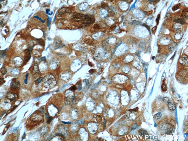 S100A4 Antibody in Immunohistochemistry (Paraffin) (IHC (P))