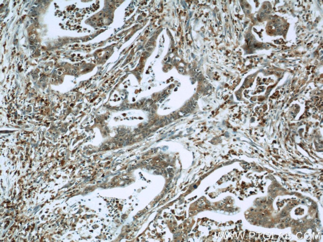 S100A4 Antibody in Immunohistochemistry (Paraffin) (IHC (P))