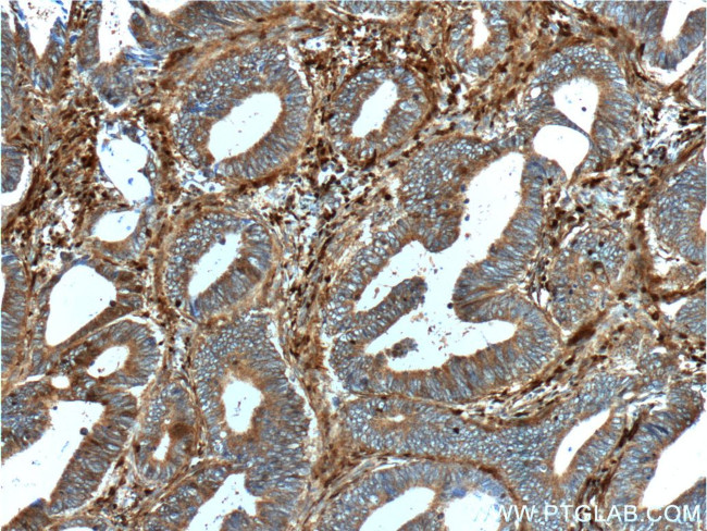 S100A4 Antibody in Immunohistochemistry (Paraffin) (IHC (P))