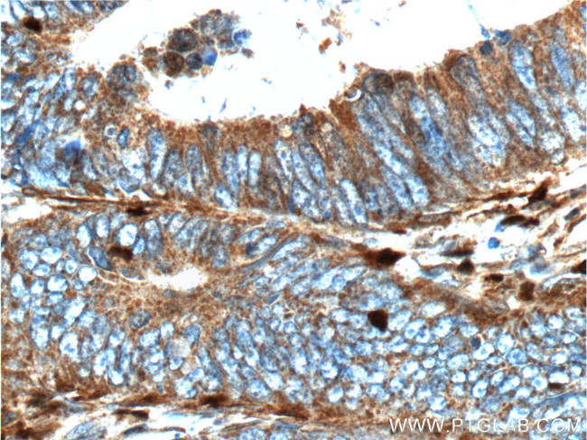 S100A4 Antibody in Immunohistochemistry (Paraffin) (IHC (P))