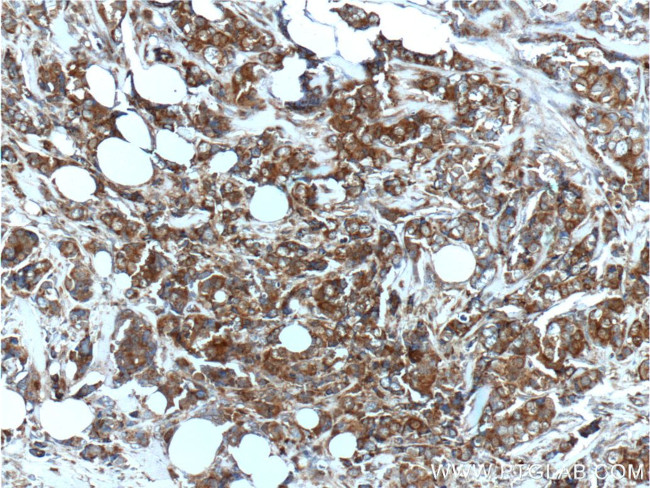 S100A4 Antibody in Immunohistochemistry (Paraffin) (IHC (P))