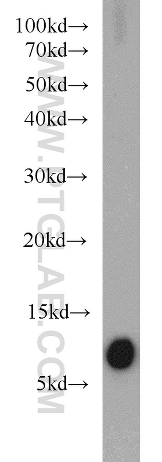 S100A4 Antibody in Western Blot (WB)