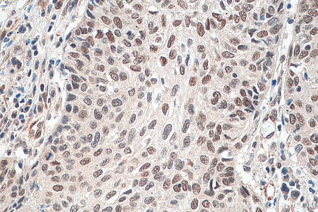 HSF1 Antibody in Immunohistochemistry (Paraffin) (IHC (P))