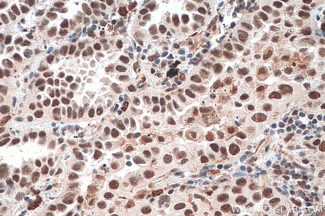 HSF1 Antibody in Immunohistochemistry (Paraffin) (IHC (P))