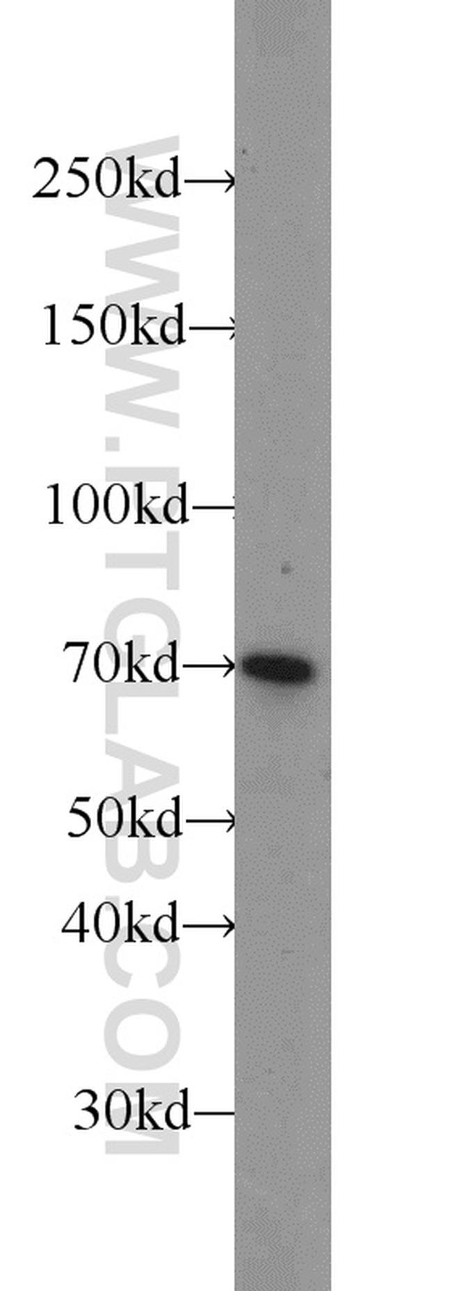 HSF1 Antibody in Western Blot (WB)