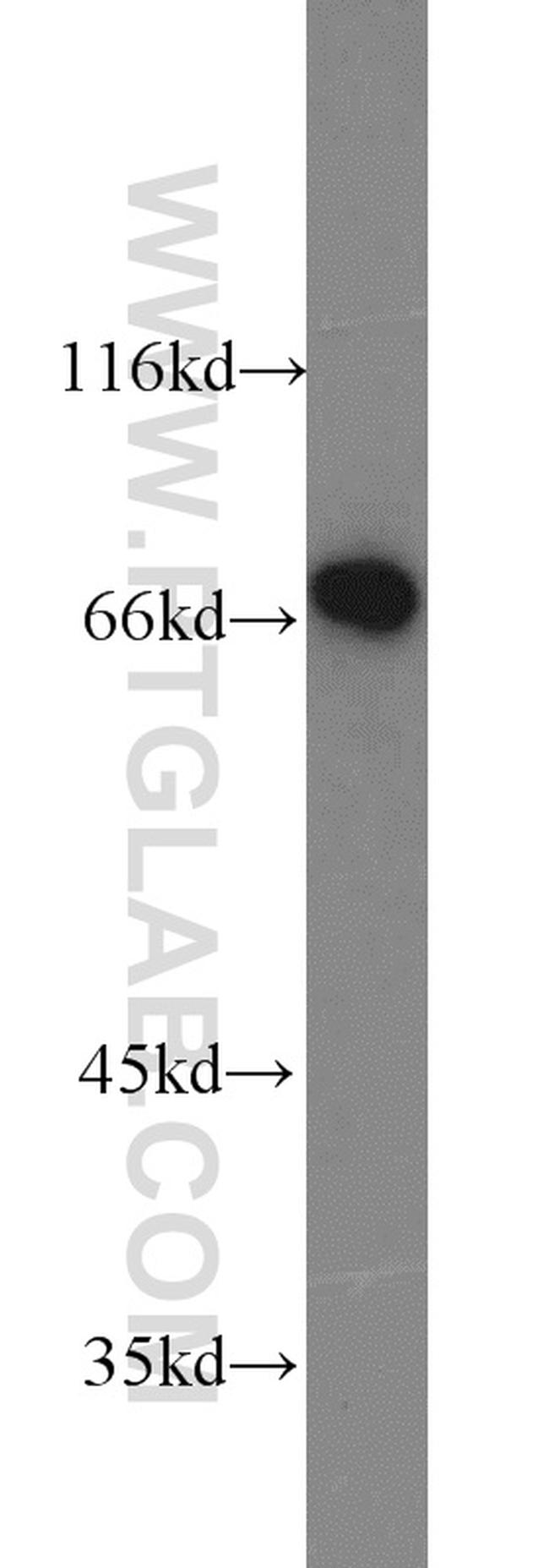 HSF1 Antibody in Western Blot (WB)