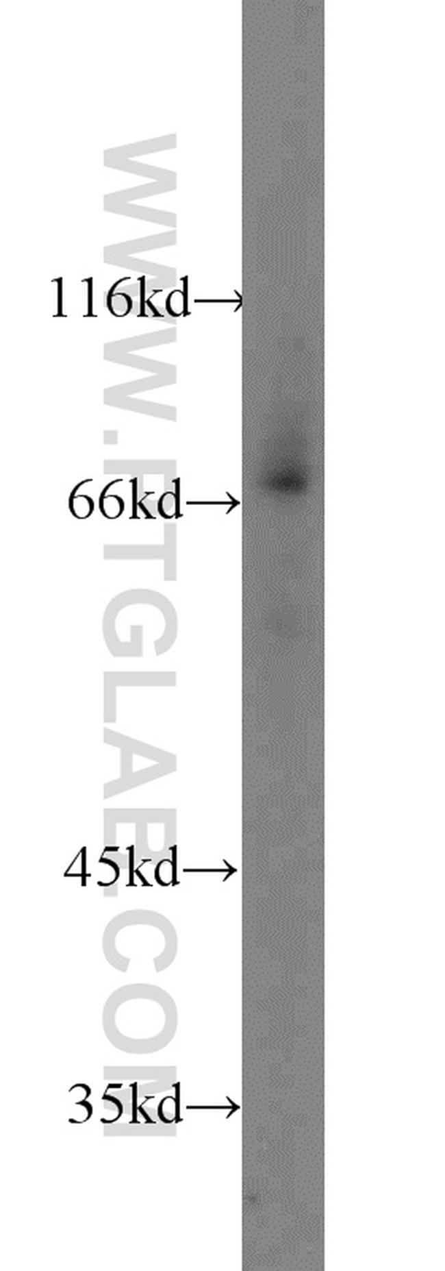 HSF1 Antibody in Western Blot (WB)