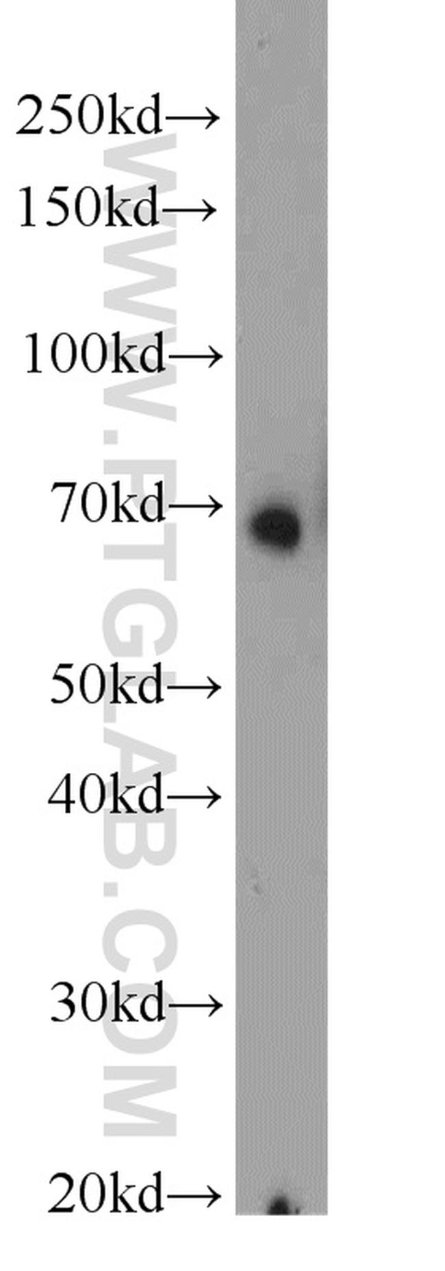 HSF1 Antibody in Western Blot (WB)