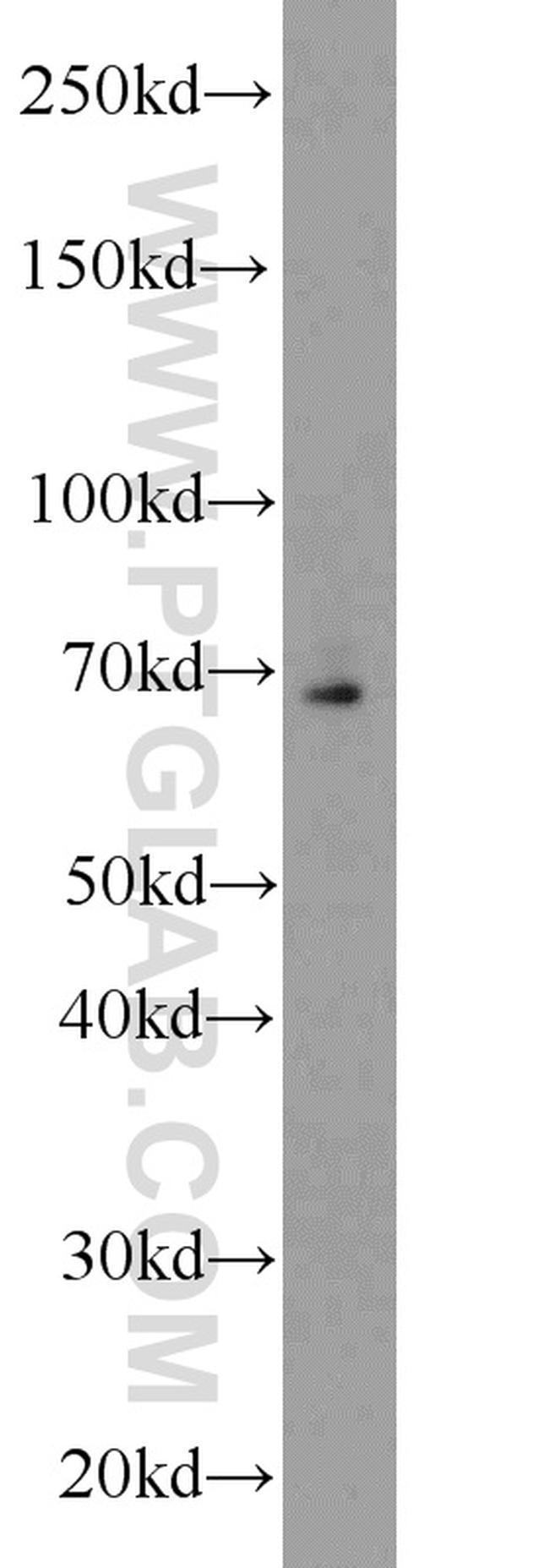 HSF1 Antibody in Western Blot (WB)