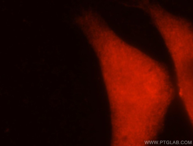 PBK Antibody in Immunocytochemistry (ICC/IF)