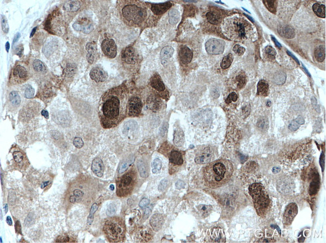 PBK Antibody in Immunohistochemistry (Paraffin) (IHC (P))