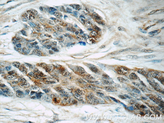 PBK Antibody in Immunohistochemistry (Paraffin) (IHC (P))