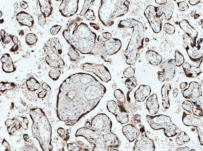 PBK Antibody in Immunohistochemistry (Paraffin) (IHC (P))